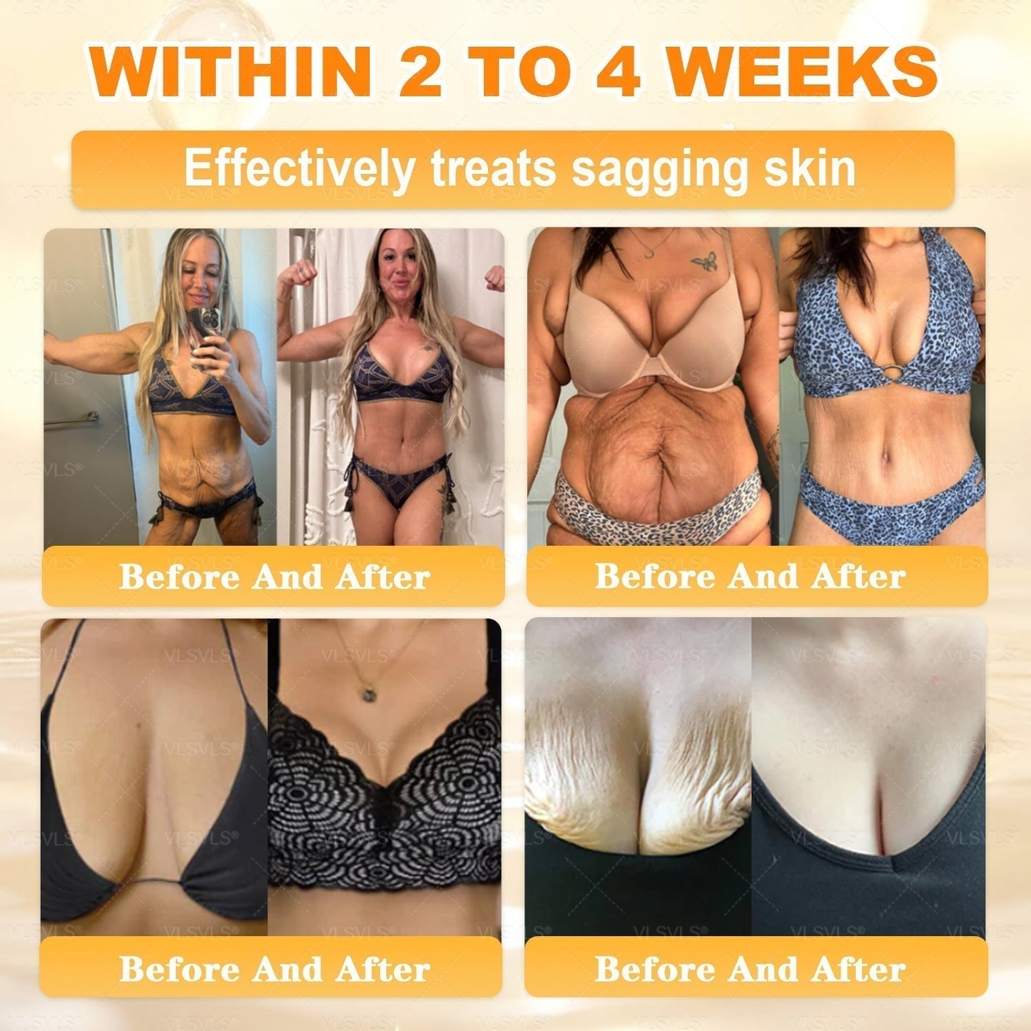 🔥 LAST DAY 80% OFF🔥 Aeehfeng® Bee Venom Skin Restoration Cream
